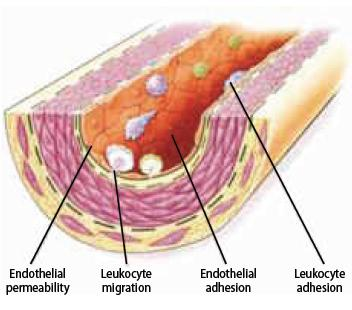 File:Figure 8 - Endothelial dysfunction - Leukocyte adhesion and migration into the deep layer of the intima.png