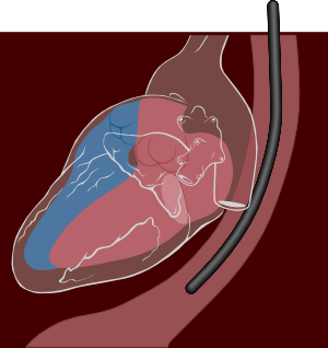 Transesophageal echocardiography diagram.svg