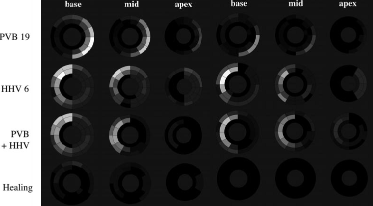 Mycoarditis virus specific patterns.png