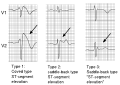 Thumbnail for version as of 10:07, 21 March 2013