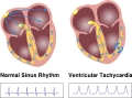 Thumbnail for version as of 17:06, 18 December 2012