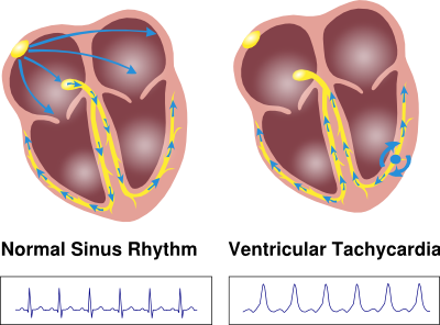 SR VT.svg