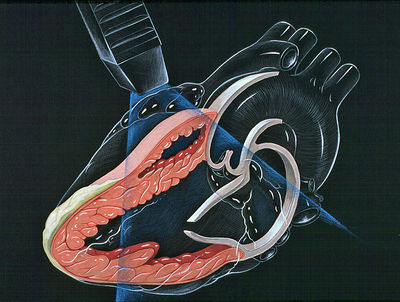 Heart lpla echocardiography diagram.jpg