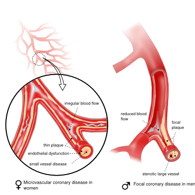 Women S Heart Health Textbook Of Cardiology
