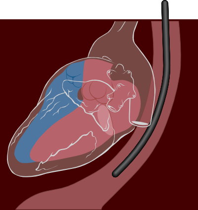 Transesophageal echocardiography diagram.svg