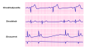 Thumbnail for version as of 18:29, 4 February 2012