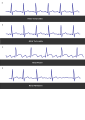 Thumbnail for version as of 09:23, 10 May 2012
