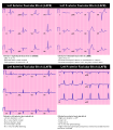 Thumbnail for version as of 18:30, 4 February 2012
