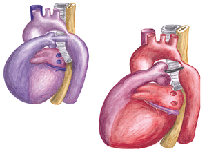 Figure 9. Schematic drawing of the anatomy prenatal and postnatal.png