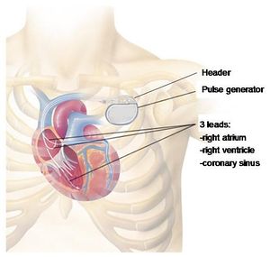 Schematic.jpg