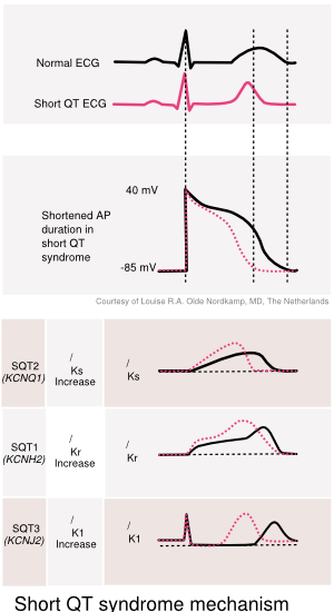 ShortQT syndrome mechanism.svg