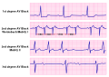 Thumbnail for version as of 18:30, 4 February 2012