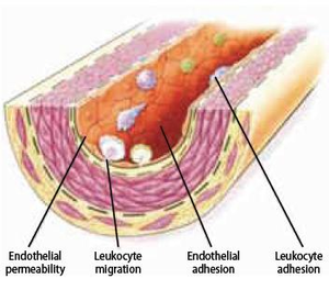 Figure 8 - Endothelial dysfunction - Leukocyte adhesion and migration into the deep layer of the intima.png